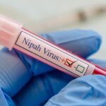 Mengenal Virus Nipah, Penyakit Mematikan yang Mulai Jadi Perhatian Dunia