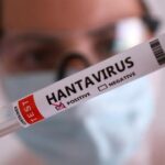 Waspada Hantavirus dari Tikus, Kemenkes Laporkan 3 Korban Jiwa